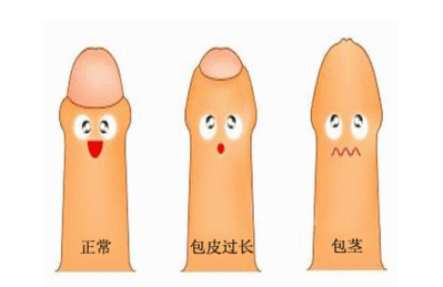 治疗包皮过长的医院