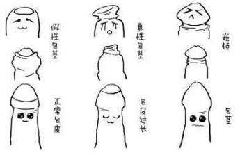 包皮手术后要多久才可以过性生活