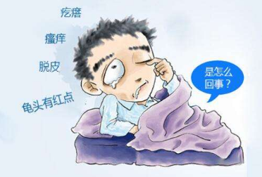 上海男性龟头炎如何治疗