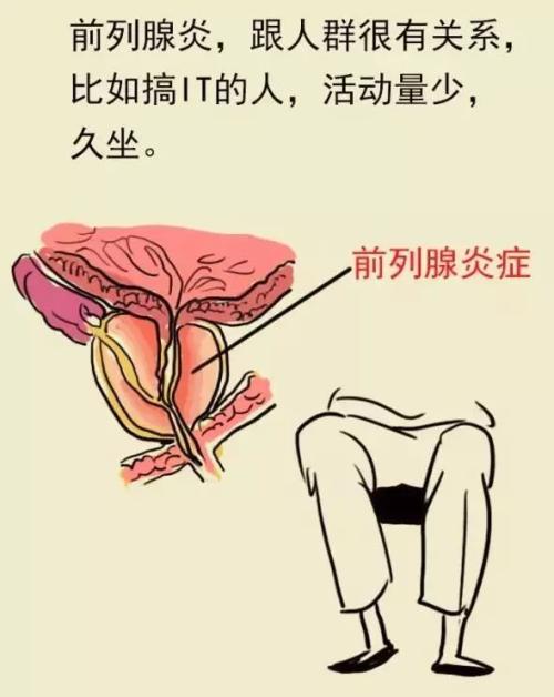 男性为什么会出现前列腺炎