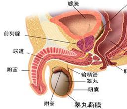 男性得了附睾炎应该怎么做