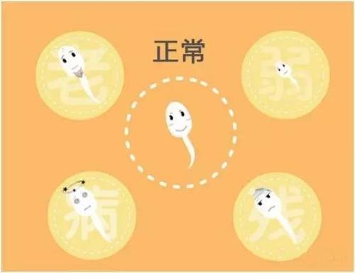 男性得了精子畸形会有哪些表现