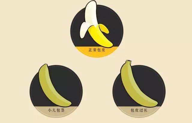 包皮过长会引发早泄吗