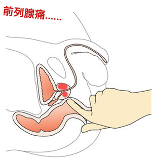 上海男人怎么【预防前列腺痛】
