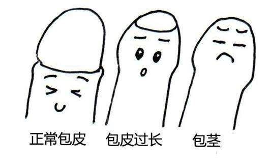 男人患了包茎怎么办?不做手术有影响吗?