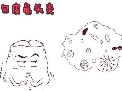 别让包皮龟头炎伤害到自己的“宝贝”