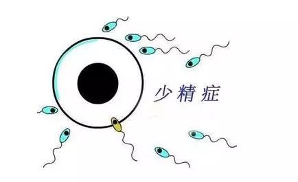 精子越来越少,及时预防才是关键