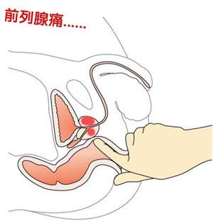 哪些不良习惯容易引起前列腺痛呢